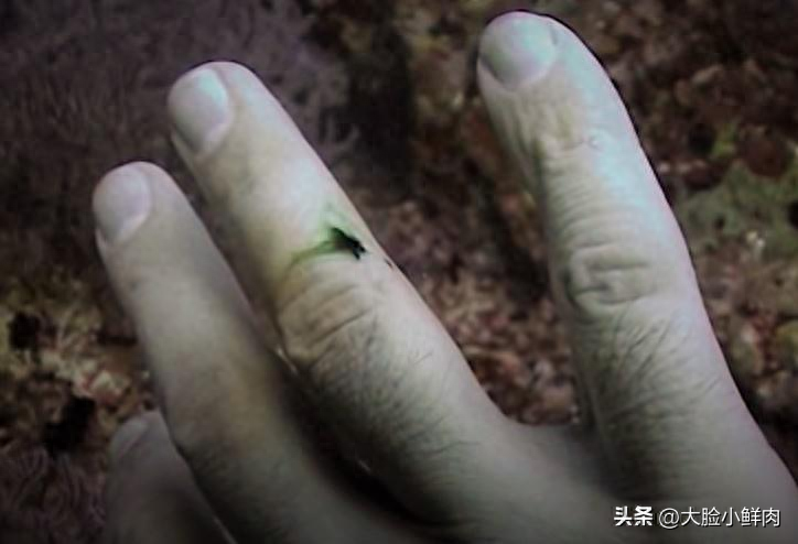 潜水员在水下被海鳗咬伤，他流的血变成了绿色的